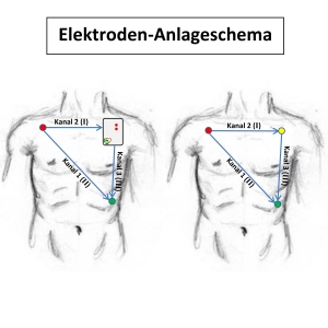 Patientenkabel zu SmartHolter24 Kobold