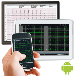 SmartScript mobile EKG-Paket